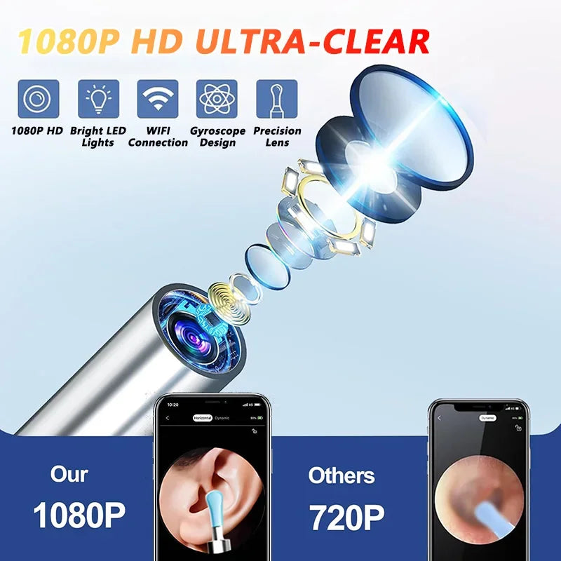 Visual Ear Wax Cleaner with Camera Safe Earwax Removal Endoscope with 5M Camera Luminous Otoscope Ear Cleaning Tools Ear Care – HD Camera, Wireless, LED Light, Smart Ear Cleaner - HNspire